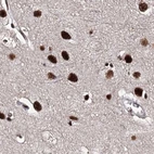 Immunohistochemical staining of human cerebral cortex using Anti-U2SURP antibody HPA037546.