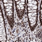 Immunohistochemical staining of human colon using Anti-U2SURP antibody HPA037546.