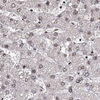 Immunohistochemical staining of human liver using Anti-U2SURP antibody HPA037546.