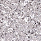 Immunohistochemical staining of human liver using Anti-U2SURP antibody HPA037546.