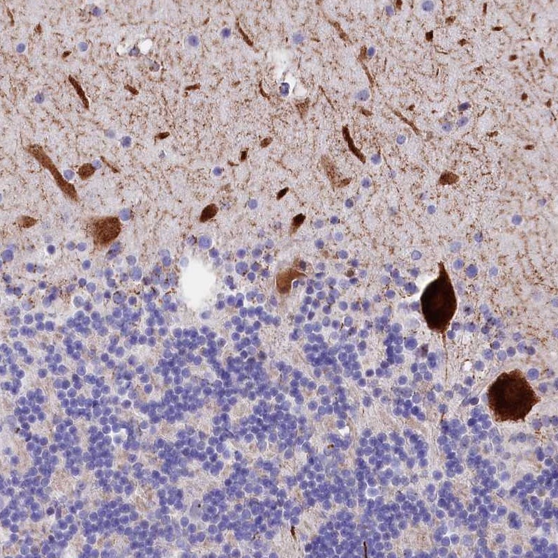 Anti-RPUSD3 Antibody