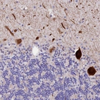 Anti-RPUSD3 Antibody