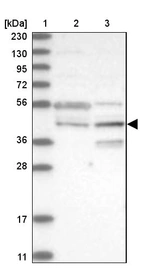 Lane 1: Marker [kDa] 230, 130, 95, 72, 56, 36, 28, 17, 11_br/_Lane 2: Human cell line RT-4_br/_Lane 3: Human cell line U-251MG sp