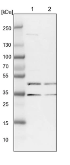 Lane 1: NIH-3T3 cell lysate (Mouse embryonic fibroblast cells)_br/_Lane 2: NBT-II cell lysate (Rat Wistar bladder tumour cells)