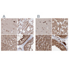 Anti-MKRN2 Antibody