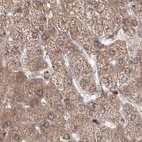 Immunohistochemical staining of human liver using Anti-MKRN2 antibody HPA037559.