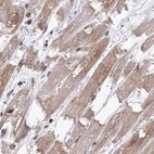 Immunohistochemical staining of human heart muscle using Anti-MKRN2 antibody HPA037559.