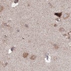 Immunohistochemical staining of human cerebral cortex using Anti-MKRN2 antibody HPA037559.