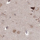 Immunohistochemical staining of human cerebral cortex using Anti-MKRN2 antibody HPA037559.