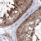Immunohistochemical staining of human testis using Anti-MKRN2 antibody HPA037559.