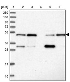 Lane 1: Marker [kDa] 250, 130, 95, 72, 55, 36, 28, 17, 10_br/_Lane 2: Human cell line RT-4_br/_Lane 3: Human cell line U-251MG sp_br/_Lane 4: Human plasma (IgG/HSA depleted)_br/_Lane 5: Human liver tissue_br/_Lane 6: Human tonsil tissue