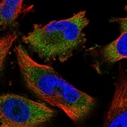Immunofluorescent staining of human cell line U-251 MG shows localization to cytosol.
