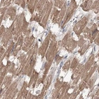 Immunohistochemical staining of human heart muscle using Anti-MKRN2 antibody HPA037560.