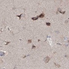 Immunohistochemical staining of human cerebral cortex using Anti-MKRN2 antibody HPA037560.