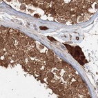 Immunohistochemical staining of human testis using Anti-MKRN2 antibody HPA037560.