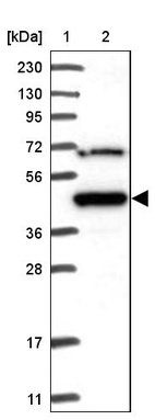 Lane 1: Marker [kDa] 230, 130, 95, 72, 56, 36, 28, 17, 11_br/_Lane 2: Human cell line RT-4