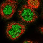 Immunofluorescent staining of human cell line A-431 shows localization to nucleoplasm & cytosol.