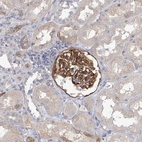 Immunohistochemical staining of human kidney shows strong cytoplasmic positivity in cells in glomeruli.
