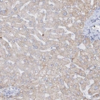 Immunohistochemical staining of human liver shows weak cytoplasmic positivity in hepatocytes.