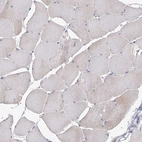 Immunohistochemical staining of human skeletal muscle shows very weak positivity in myocytes.