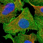 Immunofluorescent staining of human cell line U-2 OS shows localization to plasma membrane.