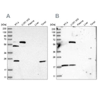 Western blot analysis using Anti-PYROXD2 antibody HPA037566 (A) shows similar pattern to independent antibody HPA037567 (B).