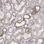 Anti-ATAD1 Antibody