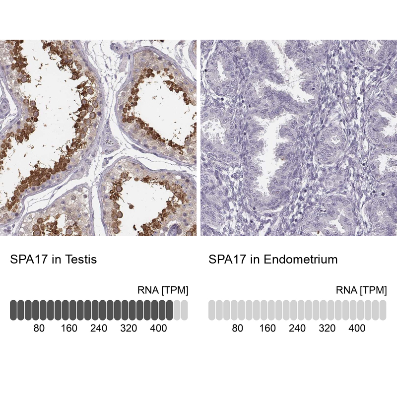 Anti-SPA17 Antibody
