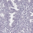 Immunohistochemical staining of human endometrium shows low expression as expected.