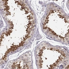 Immunohistochemical staining of human testis shows high expression.