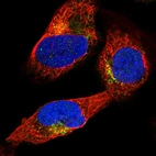 Immunofluorescent staining of human cell line U-2 OS shows localization to vesicles.