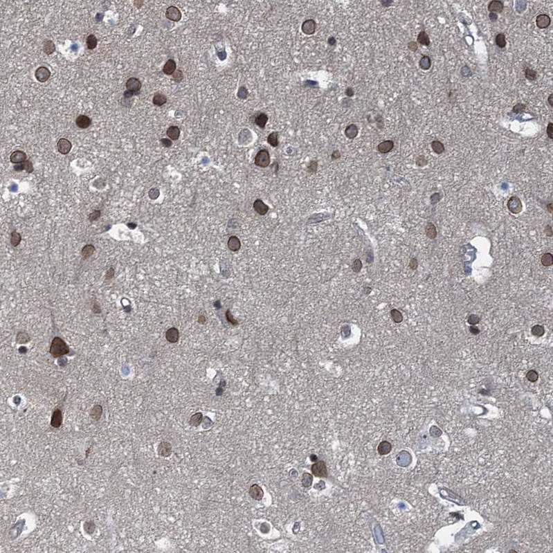 Anti-CCDC34 Antibody