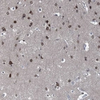 Anti-CCDC34 Antibody