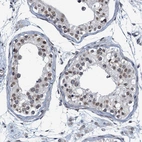 Immunohistochemical staining of human testis shows moderate nuclear membrane positivity in cells in seminiferous ducts.