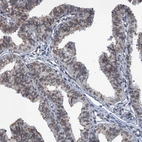 Immunohistochemical staining of human fallopian tube shows moderate nuclear membrane positivity in glandular cells.