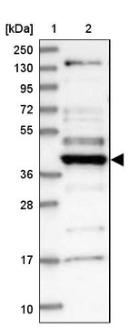 Anti-CCDC34 Antibody