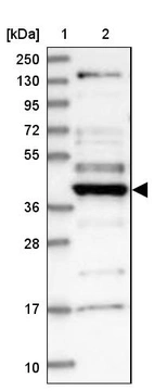 Lane 1: Marker [kDa] 250, 130, 95, 72, 55, 36, 28, 17, 10_br/_Lane 2: Human cell line RT-4