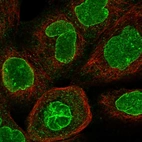Immunofluorescent staining of human cell line A-431 shows localization to nucleoli fibrillar center & nuclear membrane.