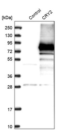 Western blot analysis in control (vector only transfected HEK293T lysate) and CRY2 over-expression lysate (Co-expressed with a C-terminal myc-DDK tag (~3.1 kDa) in mammalian HEK293T cells, LY412078).
