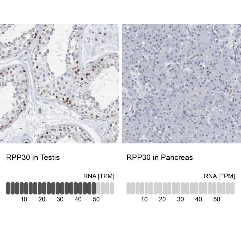 Anti-RPP30 Antibody