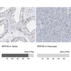 Anti-RPP30 Antibody