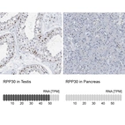 Anti-RPP30 Antibody