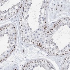 Immunohistochemical staining of human testis shows high expression.