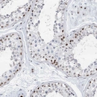Immunohistochemical staining of human testis shows high expression.