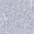 Anti-RPP30 Antibody