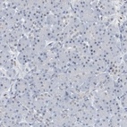 Immunohistochemical staining of human pancreas shows low expression as expected.