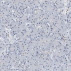 Immunohistochemical staining of human pancreas shows low expression as expected.