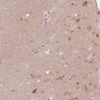 Immunohistochemical staining of human hippocampus shows moderate cytoplasmic positivity in neurons.
