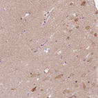 Immunohistochemical staining of human hippocampus shows moderate cytoplasmic positivity in neurons.