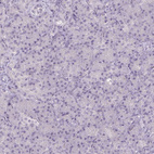 Anti-FAM168A Antibody